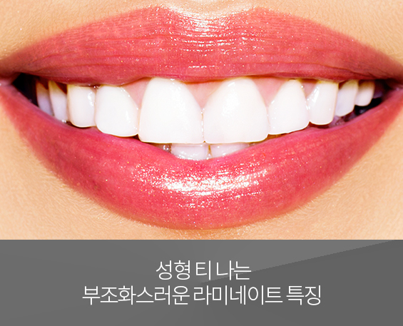 부조화스러운 라미네이트
