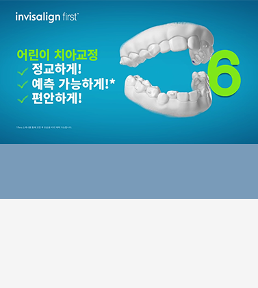어린이 치아교정용 투명 장치
