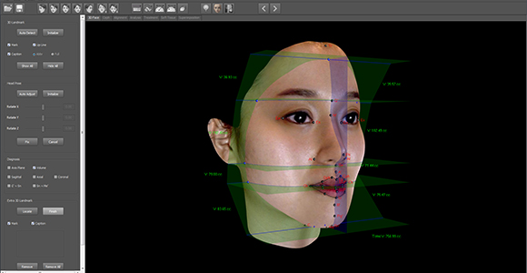 3D안모분석