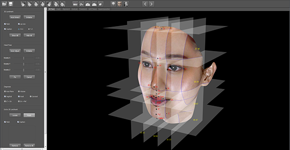 방사선영상과 3D안모영상