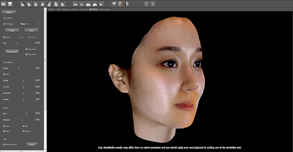 3d교정 시뮬레이션