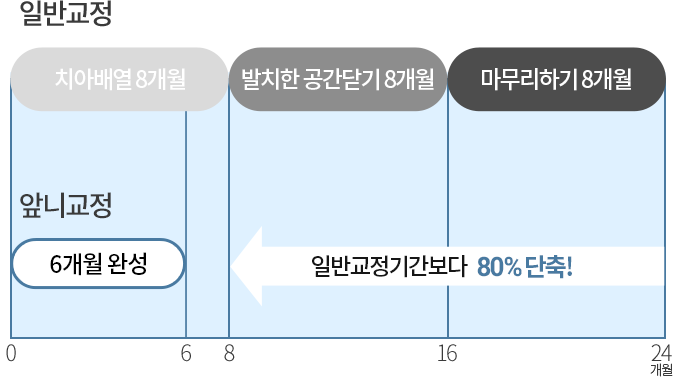 앞니교정치료기간단축