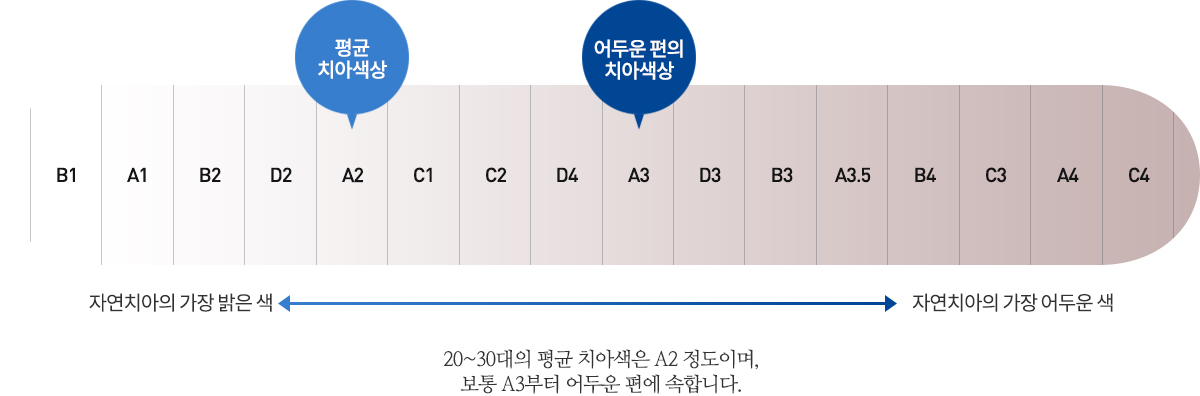 치아색상의 단계